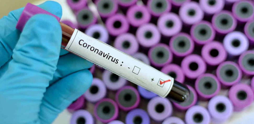 Israel se moviliza para encontrar soluciones al coronavirus